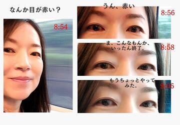 白目をクリアにする美容気功、自分にやってみた