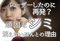 レーザーで消したのにまた出てきた…「しつこいシミ」の本当の原因とは？